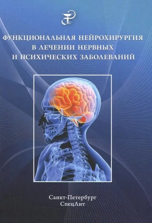 Функциональная нейрохирургия в лечении нервных заболеваний