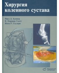 Хирургия коленного сустава