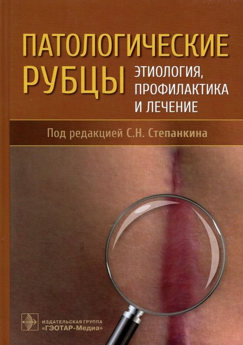 Патологические рубцы. Этиология, профилактика и лечение