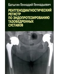 Рентгенологический регистр по эндопротезированию тазобедренных суставов