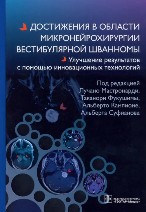 Достижения в области микронейрохирургии вестибулярной шванномы