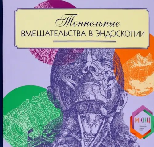 Тоннельные вмешательства в эндоскопии