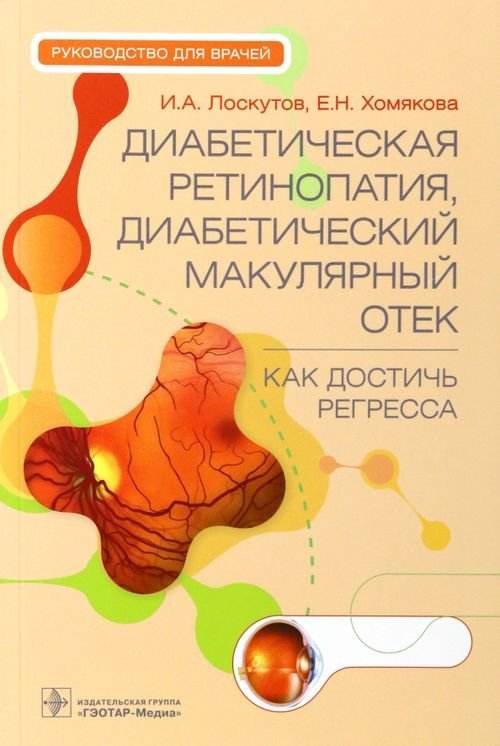 Диабетическая ретинопатия, диабетический макулярный отек - как достичь регресса. Руководство