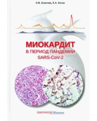 Миокардит в период пандемии SARS-CoV-2