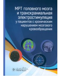 МРТ головного мозга и транскраниальная электростимуляция у пациентов с хроническим нарушением