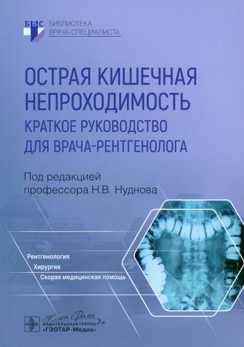 Острая кишечная непроходимость. Краткое руководство для врача-рентгенолога