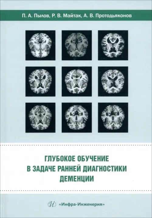 Глубокое обучение в задаче ранней диагностики деменции