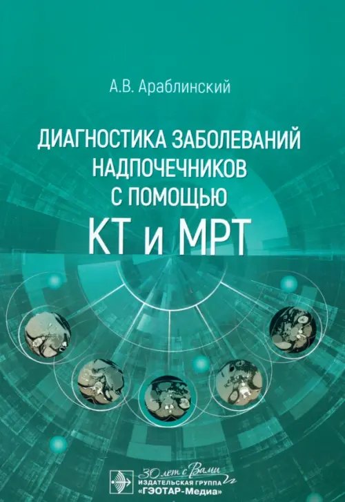 Диагностика заболеваний надпочечников с помощью КТ и МРТ