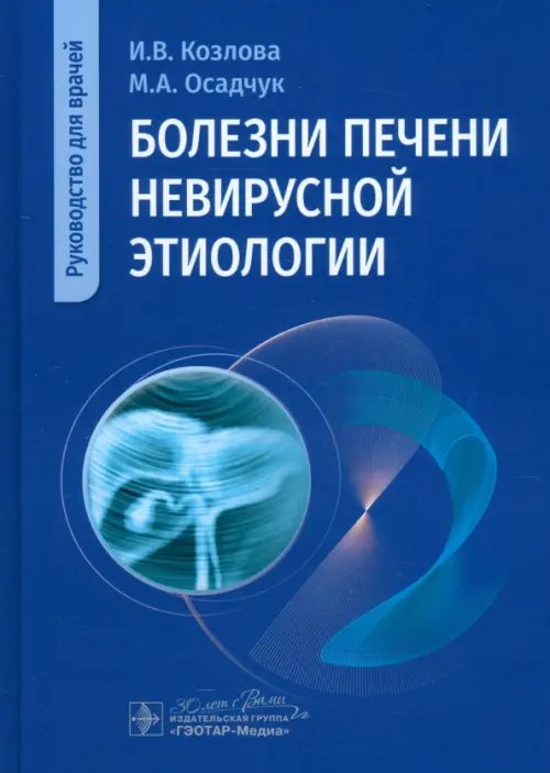 Болезни печени невирусной этиологии. Руководство