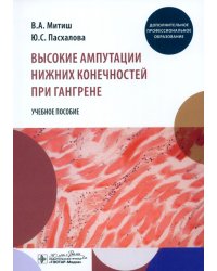 Высокие ампутации нижних конечностей при гангрене. Учебное пособие