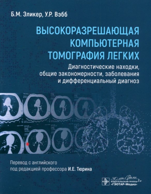 Высокоразрешающая компьютерная томография легких. Диагностические находки, общие закономерности, заболевания и дифференциальный диагноз